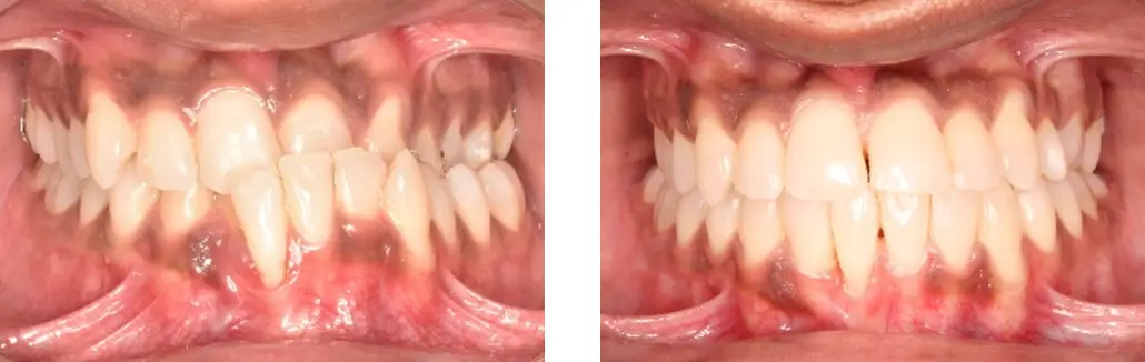 Best And Top Orthodontist Of Delhi