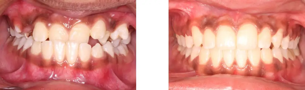 Dentist For International Patients